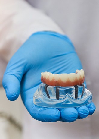 a close-up of a dentist holding a dental implant model
