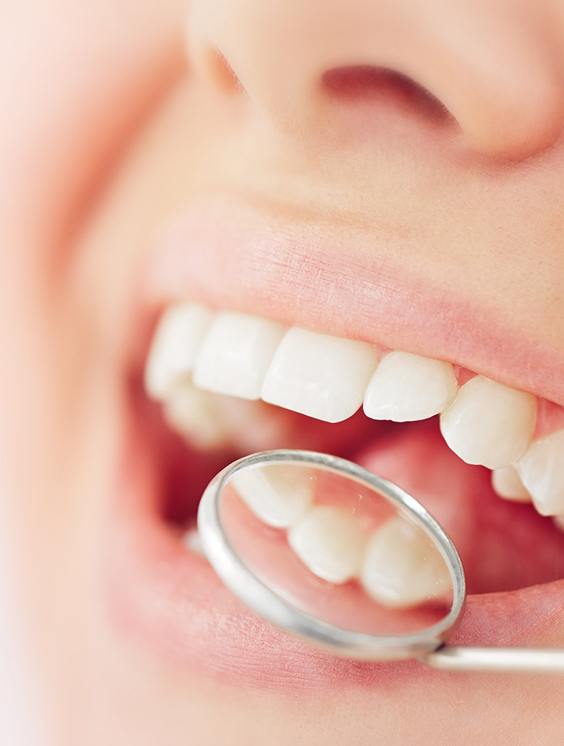 Nose-to-chin view of woman smiling with mirror reflecting her teeth