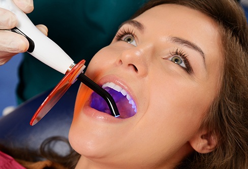 Woman’s fillings being hardened with UV light